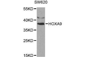 Western blot analysis of extracts of SW620 cells, using HOXA9 antibody (ABIN1873074) at 1:1000 dilution. (HOXA9 Antikörper)