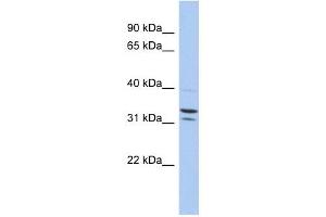 FAM92B antibody used at 1 ug/ml to detect target protein. (FAM92B Antikörper  (N-Term))