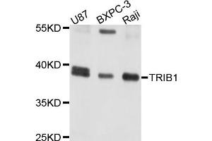 Western blot analysis of extracts of various cells, using TRIB1 antibody. (TRIB1 Antikörper)