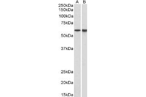 ABIN2563651 (1µg/ml) staining of Pig Bone Marrow (A) and Spleen (B) lysates (35µg protein in RIPA buffer). (LCK Antikörper  (AA 39-52))