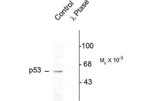 Image no. 1 for anti-Tumor Protein P53 (TP53) (pSer392) antibody (ABIN372695) (p53 Antikörper  (pSer392))