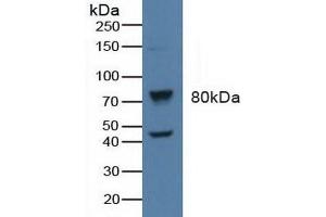 Detection of BARK in Human Raji Cells using Polyclonal Antibody to Beta Adrenergic Receptor Kinase (BARK) (beta-Adrenergic Receptor Kinase (AA 398-640) Antikörper)