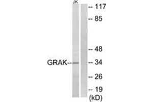 Western Blotting (WB) image for anti-Granzyme K (Granzyme 3, Tryptase II) (GZMK) (AA 61-110) antibody (ABIN2889995) (GZMK Antikörper  (AA 61-110))