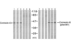 Western blot analysis of extracts from HeLa (Line 1, 4, 7 and 10), K562 (Line 2, 5, 8 and 11) and 293 (Line 3, 6, 9 and 12) cells, untreated or treated with PMA (1 η M 30min), using Connexin43 (Ab-367) antibody (E021250, Lane 1, 2, 3, 4, 5 and 6) and Connexin43 (phospho-Ser367) antibody (E011258, Lane 7, 8, 9, 10, 11 and 12). (Connexin 43/GJA1 Antikörper  (pSer367))
