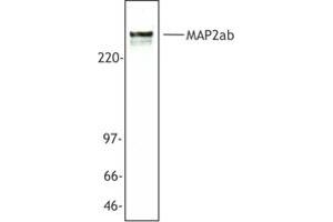 Image no. 1 for anti-Microtubule-Associated Protein 2 (MAP2) antibody (ABIN205408) (MAP2 Antikörper)