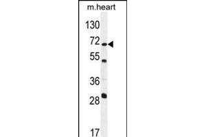 NT5C1B Antibody (N-term) (ABIN654258 and ABIN2844078) western blot analysis in mouse heart tissue lysates (35 μg/lane). (NT5C1B Antikörper  (N-Term))