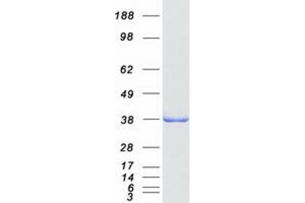 ADPRHL2 Protein (Myc-DYKDDDDK Tag)