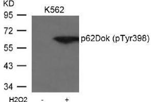Image no. 2 for anti-Docking Protein 1, 62kDa (Downstream of tyrosine Kinase 1) (DOK1) (pTyr398) antibody (ABIN197043) (DOK1 Antikörper  (pTyr398))