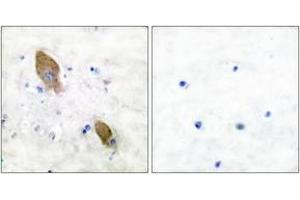 Immunohistochemistry analysis of paraffin-embedded human brain, using PYK2 (Phospho-Tyr881) Antibody. (PTK2B Antikörper  (pTyr881))