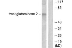 Western blot analysis of extracts from HuvEc cells, using Transglutaminase 2 Antibody. (Transglutaminase 2 Antikörper  (AA 1-50))