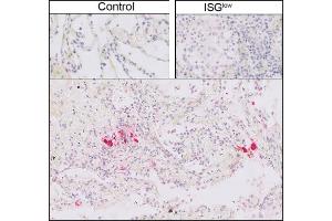 Immunohistochemistry (IHC) image for anti-SARS-Coronavirus Nucleocapsid Protein (SARS-CoV N) antibody (ABIN6952544)