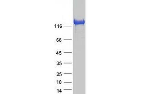 IKAP/p150 Protein (Myc-DYKDDDDK Tag)