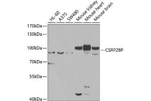 Western blot analysis of extracts of various cell lines, using CSRP2BP antibody (ABIN6127664, ABIN6139138, ABIN6139139 and ABIN6223242) at 1:1000 dilution. (CSRP2BP Antikörper  (AA 523-782))