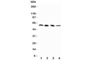 Western blot testing of RIP3 antibody and Lane 1:  PANC;  2: SW620;  3: SKOV-3;  4: M231 cell lysate (MPRIP Antikörper  (N-Term))