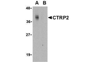 Image no. 1 for anti-C1q and Tumor Necrosis Factor Related Protein 2 (C1QTNF2) (N-Term) antibody (ABIN207816) (C1QTNF2 Antikörper  (N-Term))
