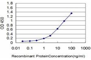 Detection limit for recombinant GST tagged IRAK2 is approximately 0. (IRAK2 Antikörper  (AA 111-210))