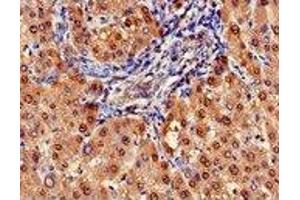 Immunohistochemistry (IHC) image for anti-Arginase, Liver (ARG1) (AA 1-322) antibody (ABIN6091458) (Liver Arginase Antikörper  (AA 1-322))