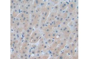 IHC-P analysis of Human Tissue, with DAB staining. (NPEPPS Antikörper  (AA 141-272))