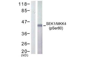 Western blot analysis of extract from 293 cells treated or untreated with UV, using SEK1/ MKK4 (phospho-Ser80) antibody (E011177). (MAP2K4 Antikörper  (pSer80))