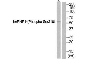 Western Blotting (WB) image for anti-Heterogeneous Nuclear Ribonucleoprotein K (HNRNPK) (pSer216) antibody (ABIN1847785) (HNRNPK Antikörper  (pSer216))