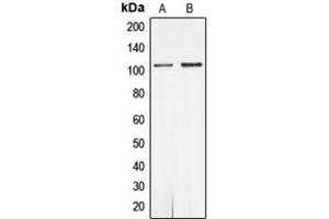 Western blot analysis of Androgen Receptor (pS650) expression in MCF7 (A), rat heart (B) whole cell lysates. (Androgen Receptor Antikörper  (pSer650))