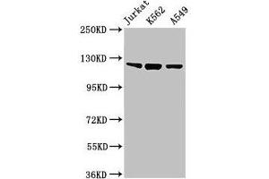 Western Blot Positive WB detected in: Jurkat whole cell lysate, K562 whole cell lysate, A549 whole cell lysate All lanes: Tlr7 antibody at 2 μg/mL Secondary Goat polyclonal to rabbit IgG at 1/50000 dilution Predicted band size: 122 kDa Observed band size: 122 kDa (TLR7 Antikörper  (AA 27-348))