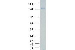 Validation with Western Blot (ROR2 Protein (Myc-DYKDDDDK Tag))