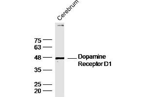 Mouse cerebrum lysates probed with DRD1 Polyclonal Antibody, unconjugated  at 1:300 overnight at 4°C followed by a conjugated secondary antibody at 1:10000 for 90 minutes at 37°C. (Dopamine Receptor d1 Antikörper  (AA 101-200))