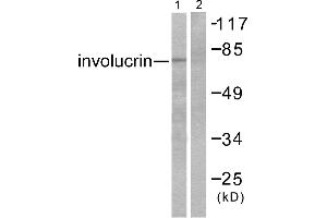 Western blot analysis of extracts from HuvEc cells, using Involucrin antibody (#C0236). (Involucrin Antikörper)