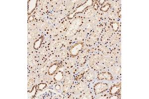 Immunohistochemistry of paraffin embedded human kidney using PAX2 (ABIN7074974) at dilution of 1:1000 (200x lens) (PAX2A Antikörper)