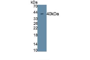 Detection of Recombinant CDH5, Rat using Monoclonal Antibody to Cadherin 5 (CDH5) (Cadherin 5 Antikörper  (AA 59-382))