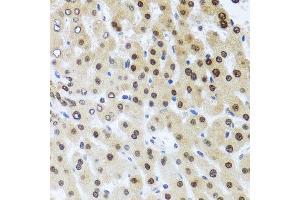 Immunohistochemistry of paraffin-embedded human liver injury using RAD23B antibody. (RAD23B Antikörper  (AA 50-150))