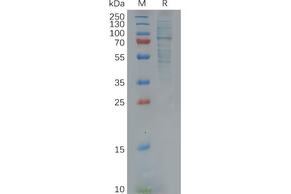 GAS6 Protein (AA 31-678) (His tag)