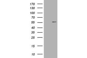 Image no. 1 for anti-Vimentin (VIM) (AA 210-466) antibody (ABIN1491203) (Vimentin Antikörper  (AA 210-466))