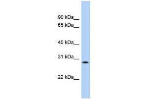 WB Suggested Anti-KCTD17 Antibody Titration:  0. (KCTD17 Antikörper  (Middle Region))
