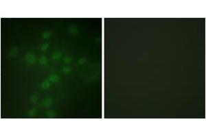 Immunofluorescence analysis of HuvEc cells, using Telomerase (Phospho-Ser227) Antibody. (TERT Antikörper  (pSer227))