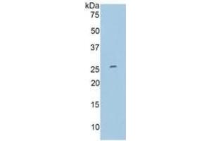 Western Blotting (WB) image for Matrix Metallopeptidase 11 (Stromelysin 3) (MMP11) ELISA Kit (ABIN6574149)