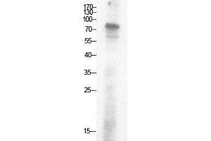 Western Blot (WB) analysis of HepG2 cells using Acetyl-Ub (K29) Polyclonal Antibody. (Ubiquitin Antikörper  (acLys29))