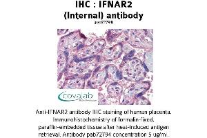 Image no. 1 for anti-Interferon alpha/beta Receptor 2 (IFNAR2) (Internal Region) antibody (ABIN1735773) (IFNAR2 Antikörper  (Internal Region))