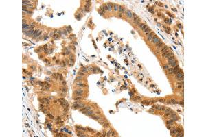 Immunohistochemistry (IHC) image for anti-Serotonin Receptor 3A (HTR3A) antibody (ABIN2427713) (Serotonin Receptor 3A Antikörper)