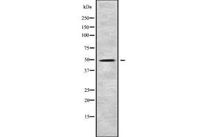 Western blot analysis of KCNJ8 using Jurkat whole cell lysates (KCNJ8 Antikörper)