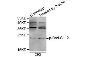 Western blot analysis of extracts of 293 cell line, using Phospho-Bad-S112 antibody (ABIN5969873). (BAD Antikörper  (pSer75))