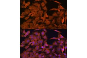 Immunofluorescence analysis of C6 cells using SRP54 Rabbit mAb (ABIN3015958, ABIN3015959, ABIN1682276, ABIN1682277 and ABIN7101466) at dilution of 1:100 (40x lens). (SRP54 Antikörper)