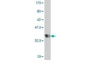 Western Blot detection against Immunogen (37. (GOLM1 Antikörper  (AA 302-401))