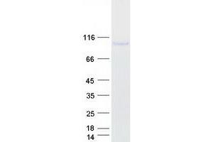 Validation with Western Blot (TLR4 Protein (Transcript Variant 1) (Myc-DYKDDDDK Tag))