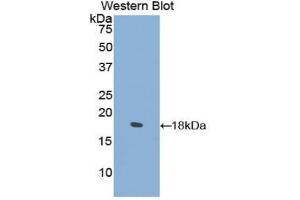 Western blot analysis of the recombinant protein. (COL2A1 Antikörper  (AA 677-817))