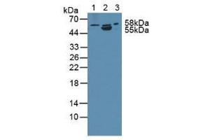 Western blot analysis of (1) Human PC-3 Cells, (2) Porcine Intestine Tissue and (3) Rat Prostate Gland Tissue. (ANTXR2 Antikörper  (AA 34-318))