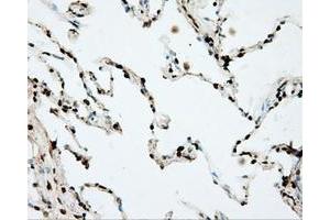 Immunohistochemical staining of paraffin-embedded prostate tissue using anti-DAPK2 mouse monoclonal antibody. (DAPK2 Antikörper)