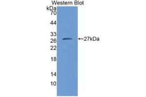 Western blot analysis of the recombinant protein. (CMA1 Antikörper  (AA 22-247))