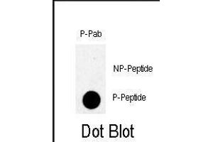 Dot blot analysis of anti-Phospho-TBK-p Antibody (ABIN390010 and ABIN2839780) on nitrocellulose membrane. (TBK (pSer172) Antikörper)